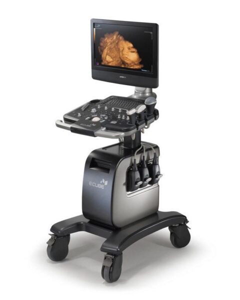 Alpinion E-CUBE 9 DIAMOND Ultrasound Machine