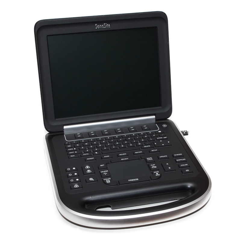 SonoScape Ultrasound Machine1