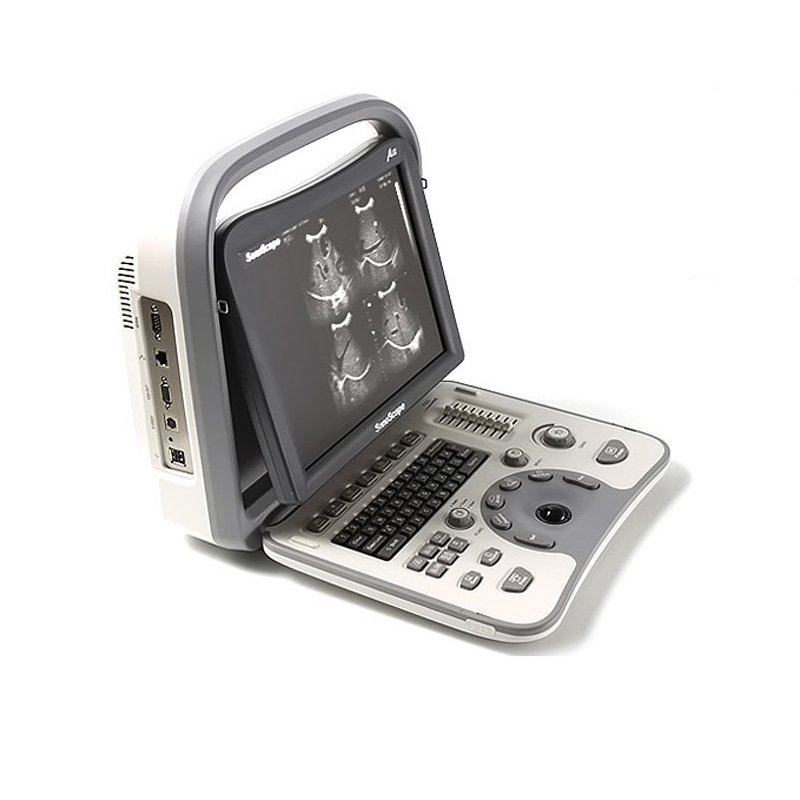 SonoScape Ultrasound Machine1
