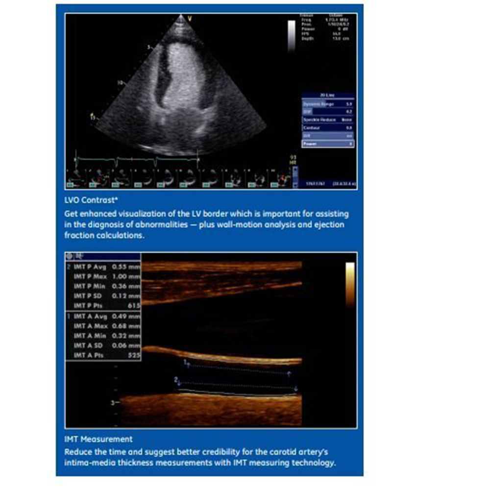 Used GE Vivid S5 Ultrasound Machine - Image 3