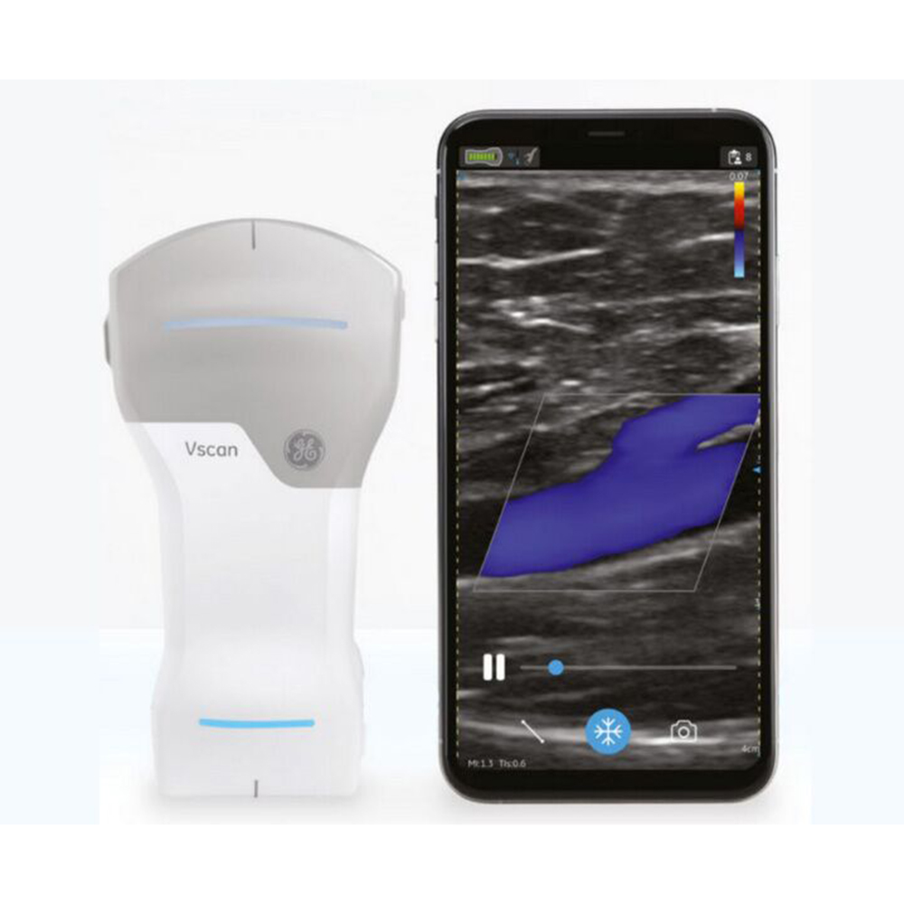 Used GE Vscan Air Ultrasound Machine - Image 3
