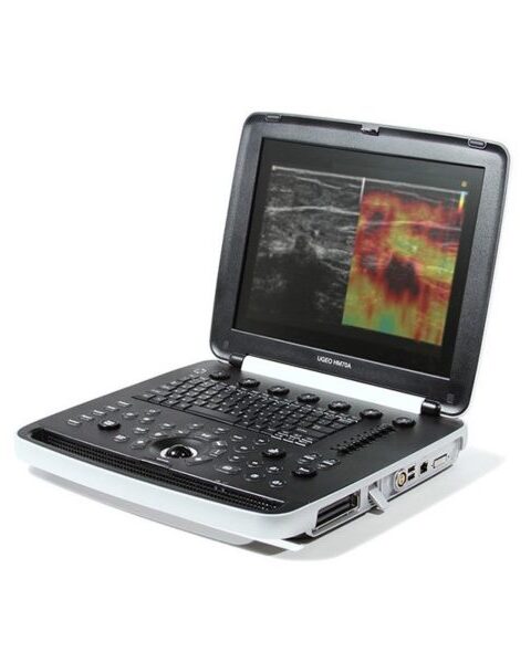 Samsung UGEO HM70A Ultrasound Machine