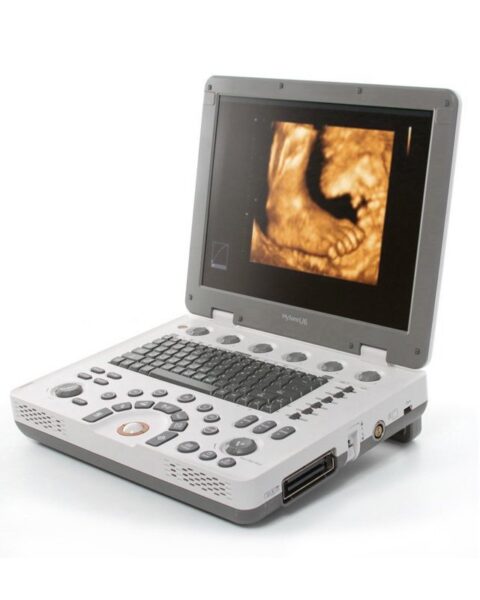 Samsung MySono U6 Ultrasound Machine
