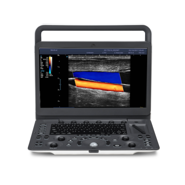 SonoScape Ultrasound Machine1