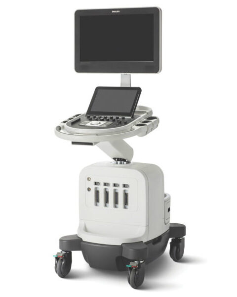 Philips Affiniti 30 Ultrasound Machine
