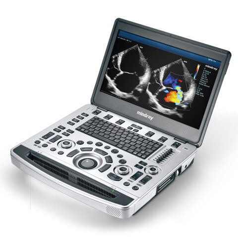 Mindray M9 Portable Ultrasound System