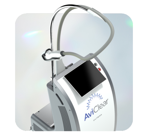 Cutera AviClear Acne Laser